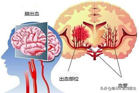 今日科普一下！吃宵夜昏迷8个月去世,百科词条爱好_2024最新更新