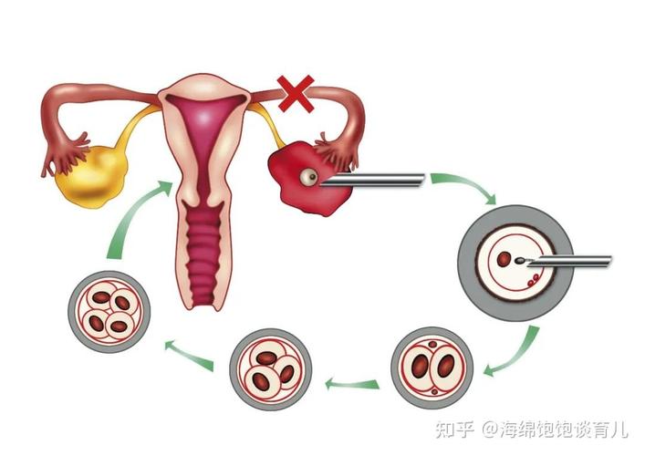 今日科普一下！举报43家代孕机构,百科词条爱好_2024最新更新